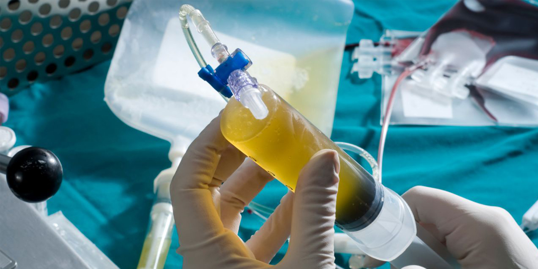 CAR T-Cell Manufacturing